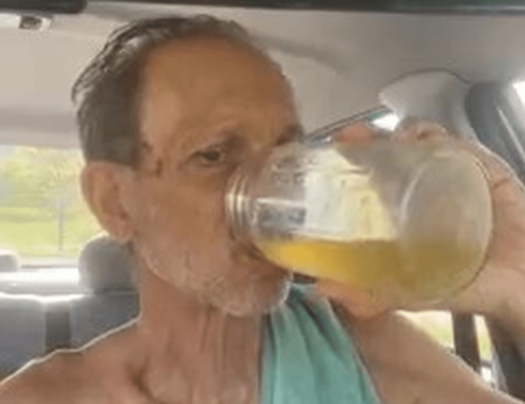 This man drinks his own URINE every morning image