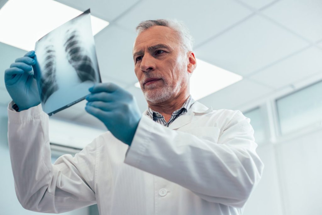 Calm mature Caucasian medical worker in white coat standing with a chest x-ray picture and looking attentively at it