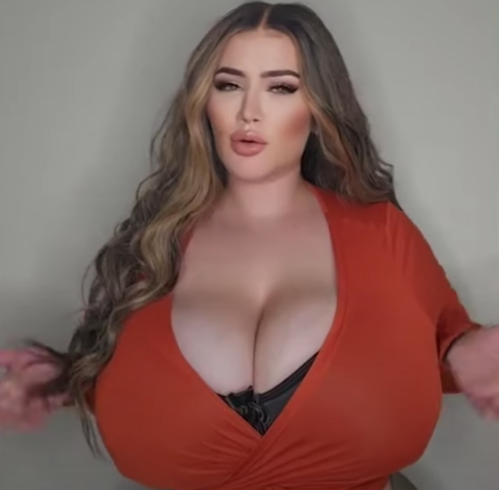 Woman with large breasts due to condition makes $313K on OnlyFans photo image